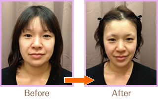 驚きの美小顔「小顔美顔矯正法」02