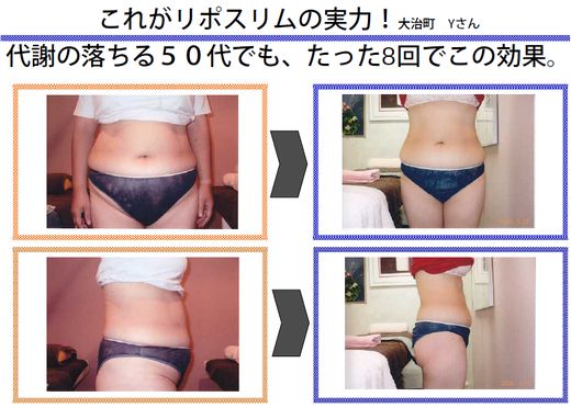 驚愕！！Lipo Slimoの効果01