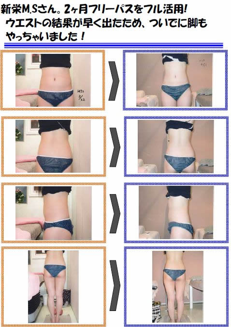 驚愕！！Lipo Slimoの効果02