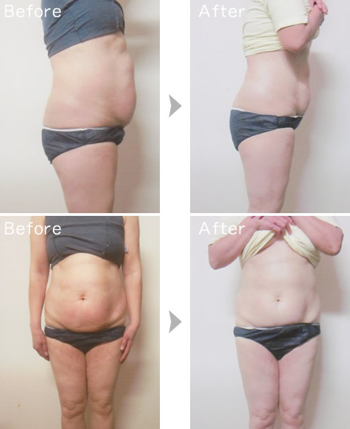 ビフォーアフター