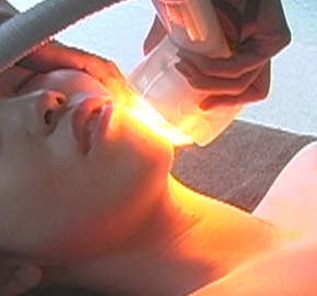 フォトフェイシャルについて01