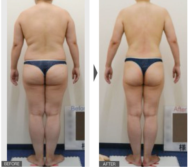 まるで別人！！-20kg！01