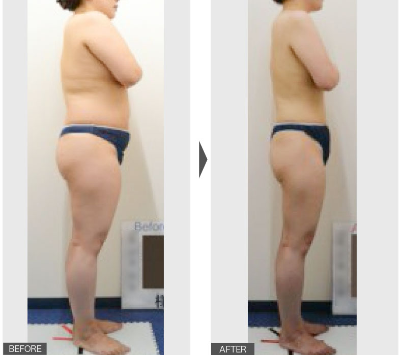 まるで別人！！-20kg！02