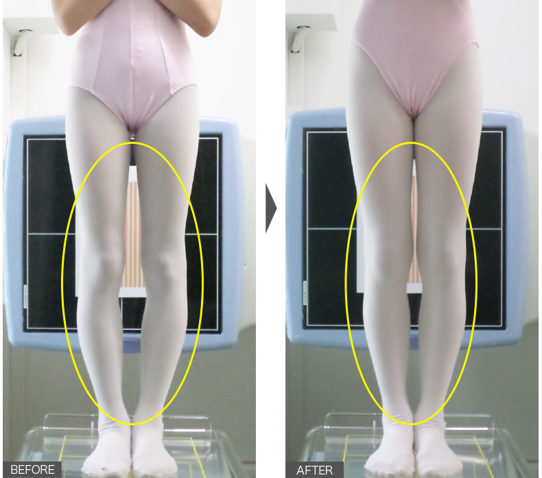 まっすぐ立って水平に線ができると要注意！01