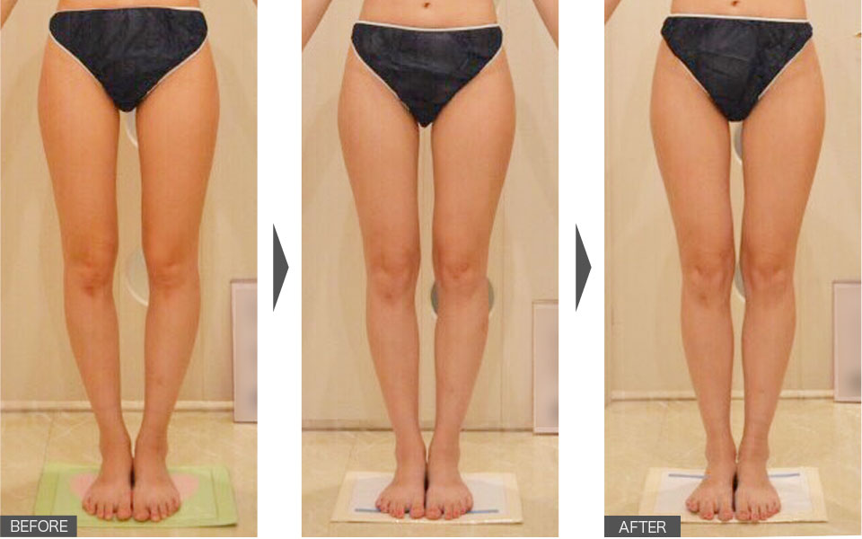 1ヶ月で骨盤が正常になり、食べても太りにくいスラっと脚に！02