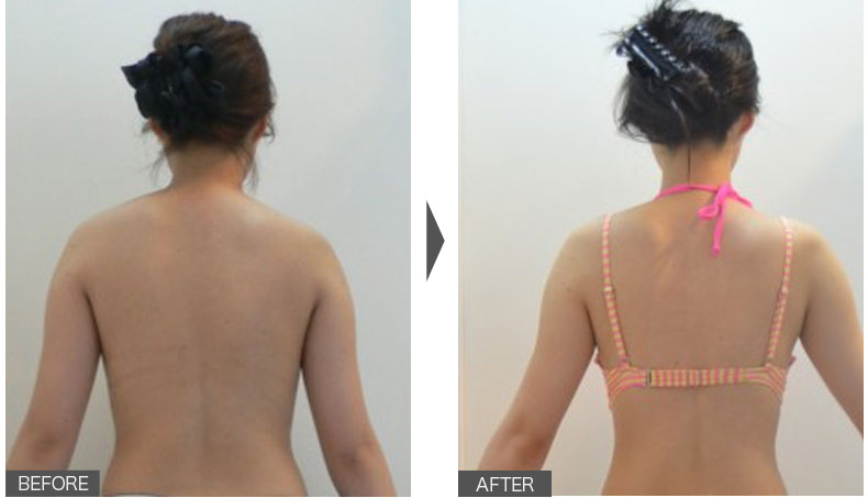 身体が軽くて楽!冬に溜め込まない身体になりました。女性