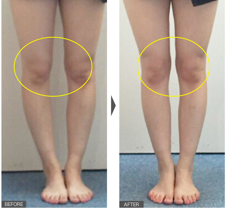 たった1回でこの効果！この違い！女性／1回