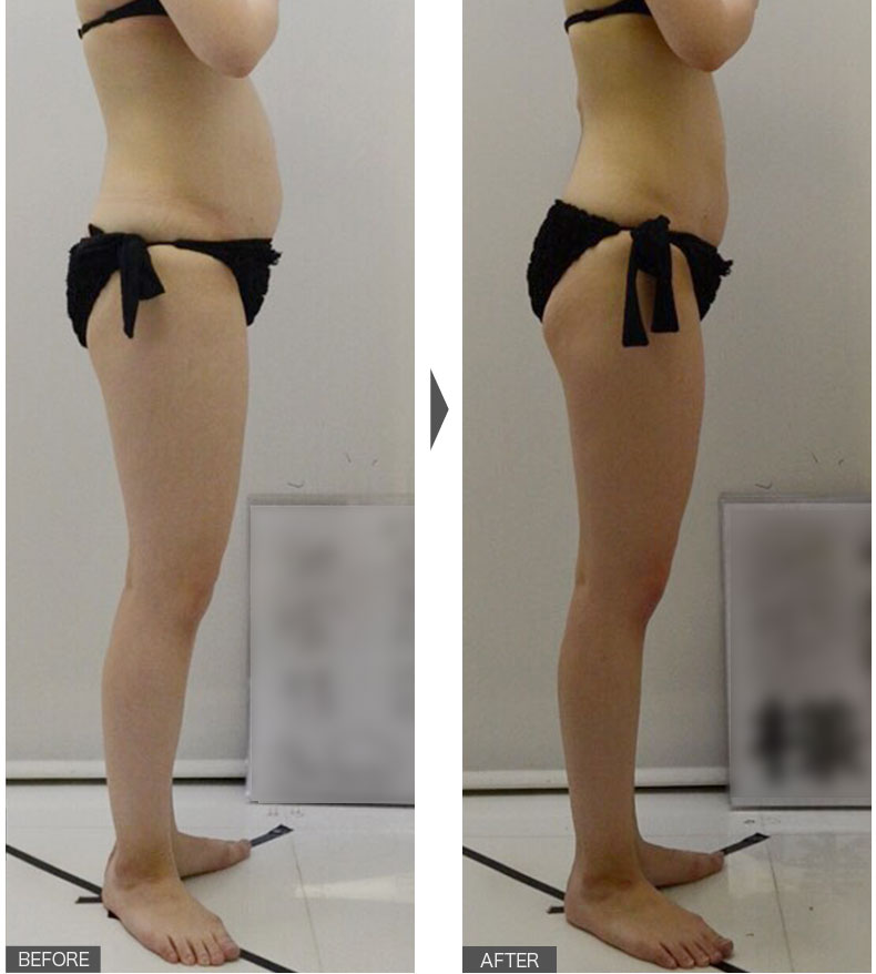 体重1.7kg減！体脂肪率2.3％減！内臓脂肪1.0%減！女性／2ヶ月