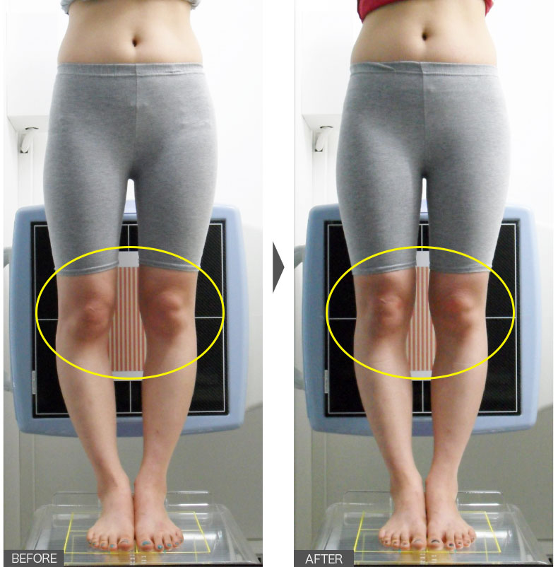 24歳女性／6週間