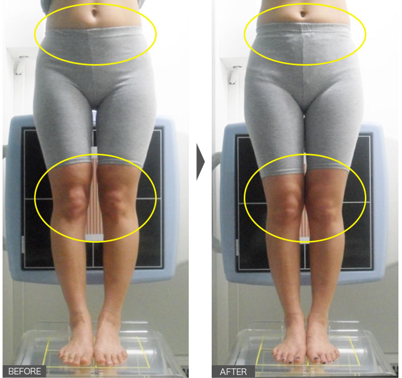 33歳女性／3週間