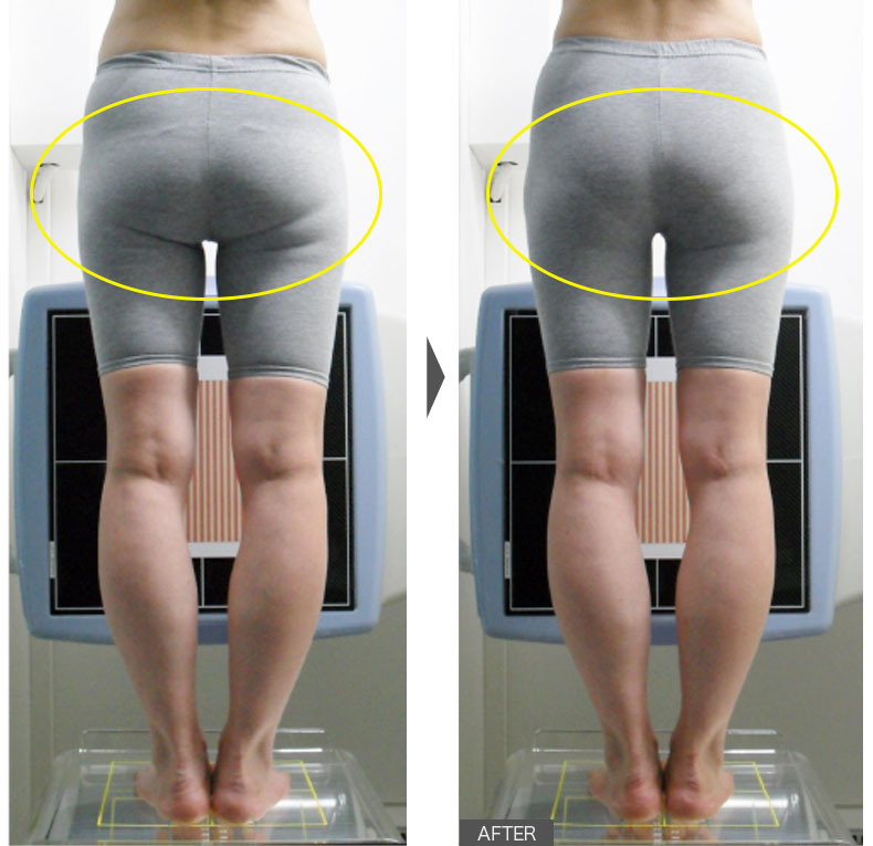 24歳女性／6週間