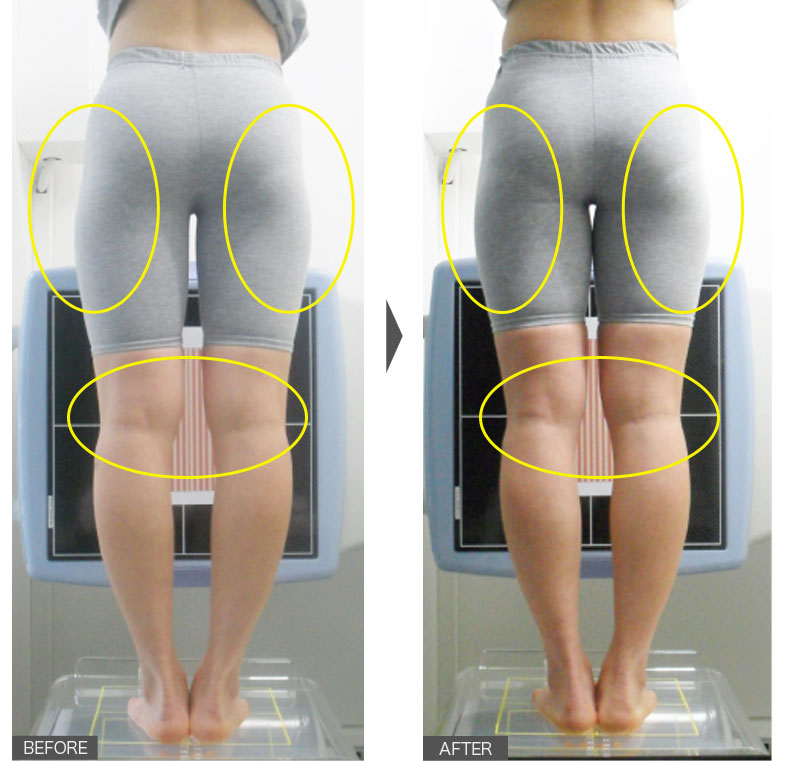 25歳女性／2週間