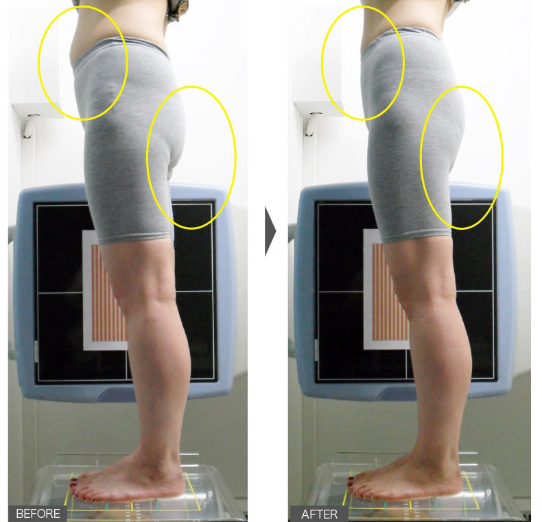 36歳女性／6週間