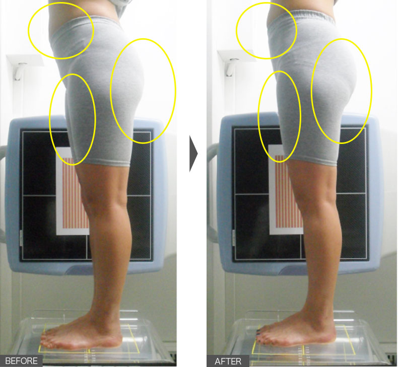 24歳女性／3週間