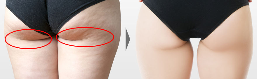 プロポーション美人へ